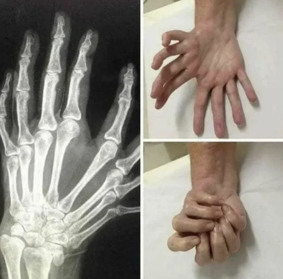 bones.png