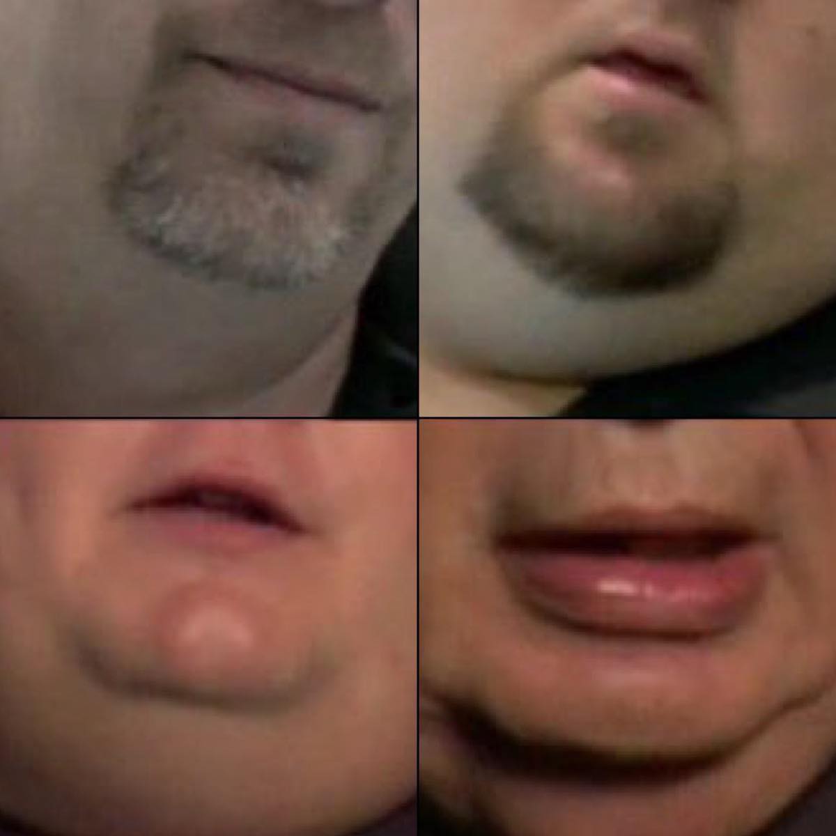 chins.jpg
