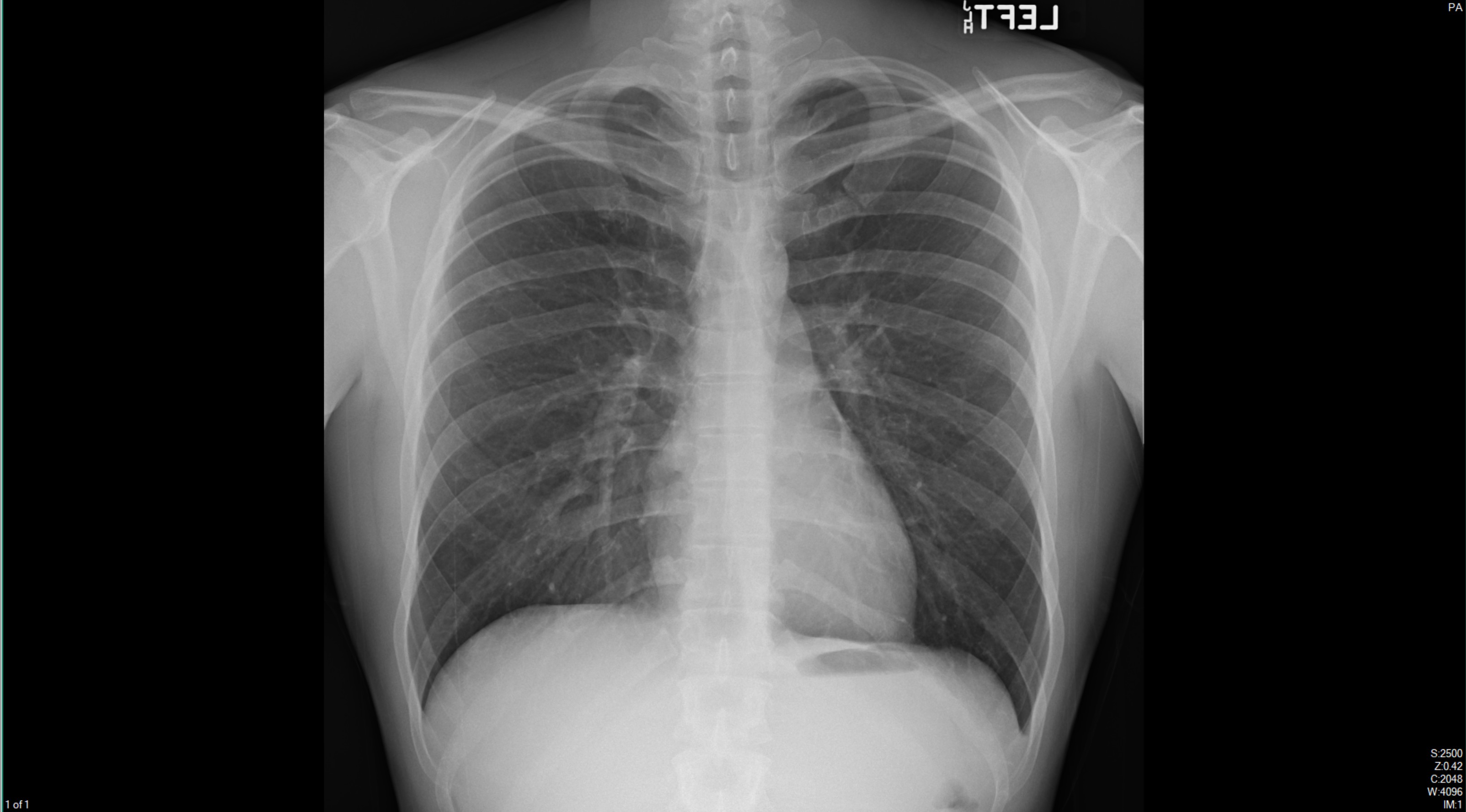 lungs.jpg
