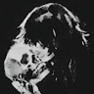 KILLHXA
