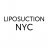 liposuctionsnyc
